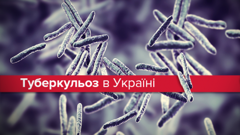 Епідемія туберкульозу в Україні: чому за 20 років проблема не подолана